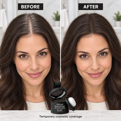 Woman before and after temporary cosmetic root coverage